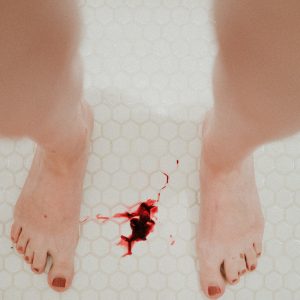 Blutfleck auf Fliesenboden zwischen zwei Füßen